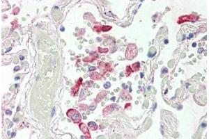 Human Lung (formalin-fixed, paraffin-embedded) stained with CES1 antibody ABIN337128 at 2.