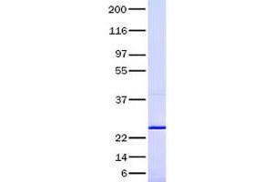 Western Blotting (WB) image for Transforming Growth Factor, beta 2 (TGFB2) (Transcript Variant 2) (Active) protein (ABIN2733497)