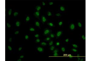 Immunofluorescence of monoclonal antibody to PRKAA1 on HeLa cell. (PRKAA1 antibody  (AA 451-550))