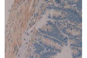 IHC-P analysis of Rat Intestine Tissue, with DAB staining. (MAP1A antibody  (AA 2110-2367))