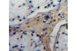 Used in DAB staining on fromalin fixed paraffin-embedded testis tissue (EPYC antibody  (AA 130-322))