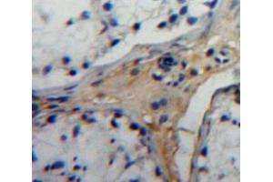 Used in DAB staining on fromalin fixed paraffin-embedded testis tissue (EPYC antibody  (AA 130-322))