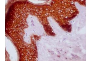 IHC image of ABIN7180977 diluted at 1:100 and staining in paraffin-embedded human skin tissue performed on a Leica BondTM system. (KRT14/KRT16/KRT5/KRT6A/KRT8 antibody)