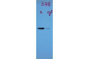 Blots of ABIN1580460 on crude extract of mouse brain nuclear fraction (left lane) and cytoplasmic fraction (right lane) blotted with monoclonal antibody ABIN1580460. (TARDBP antibody)
