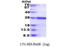 SDS-PAGE (SDS) image for RAB39B, Member RAS Oncogene Family (RAB39B) (AA 1-213) protein (His tag) (ABIN5853890) (RAB39B Protein (AA 1-213) (His tag))