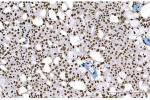 IHC analysis of Histone H1. (Histone H1 antibody  (AA 20-159))