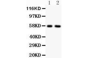 All lanes: Anti ALPL () at 0. (ALPL antibody  (N-Term))