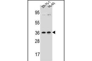 LUZP2 Antibody (N-term) (ABIN657098 and ABIN2837894) western blot analysis in ZR-75-1,HL-60 cell line lysates (35 μg/lane). (LUZP2 antibody  (N-Term))