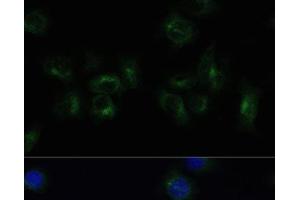 Immunofluorescence analysis of HeLa cells using CLTB Polyclonal Antibody at dilution of 1:100 (40x lens). (CLTB antibody)