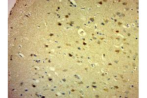 Paraformaldehyde-fixed, paraffin embedded rat brain, Antigen retrieval by boiling in sodium citrate buffer (pH6. (PARP16 antibody  (AA 120-170))