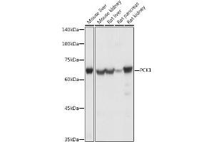 Western blot analysis of extracts of various cell lines, using PCK1 antibody (ABIN3022753, ABIN3022754, ABIN3022755 and ABIN6219210) at 1:1000 dilution. (PCK1 antibody  (C-Term))