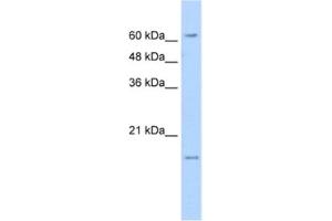 Western Blotting (WB) image for anti-Solute Carrier Family 13 Member 3 (SLC13A3) antibody (ABIN2462408) (SLC13A3 antibody)