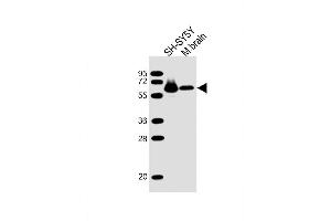Lane 1: SH-SY5Y, Lane 2: mouse brain lysate at 20 µg per lane, probed with bsm-51444M DPYSL5 (1503CT789. (DPYSL5 antibody)