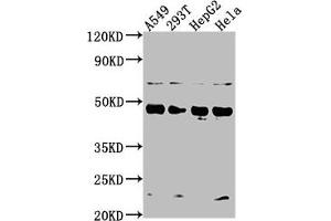 Western Blot Positive WB detected in: A549 whole cell lysate, 293T whole cell lysate, HepG2 whole cell lysate, Hela whole cell lysate All lanes: SNX5 antibody at 1:2000 Secondary Goat polyclonal to rabbit IgG at 1/50000 dilution Predicted band size: 47, 14 kDa Observed band size: 47 kDa