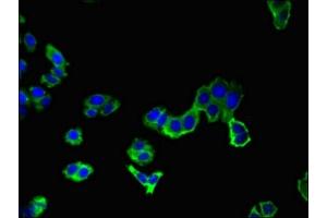 Immunofluorescent analysis of HepG2 cells using ABIN7144390 at dilution of 1:100 and Alexa Fluor 488-congugated AffiniPure Goat Anti-Rabbit IgG(H+L) (AAK1 antibody  (AA 274-465))