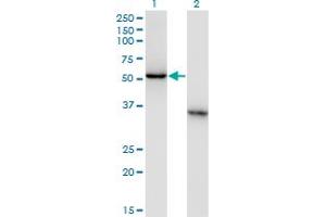 Western Blot analysis of NXF3 expression in transfected 293T cell line by NXF3 monoclonal antibody (M02), clone 2C7. (NXF3 antibody  (AA 1-100))