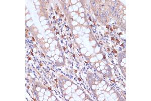 Immunohistochemistry of paraffin-embedded human colon using PI3 Kinase p85 beta antibody (ABIN7269320) at dilution of 1:200 (40x lens). (PIK3R2 antibody)