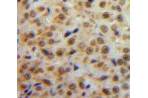 Used in DAB staining on fromalin fixed paraffin-embedded Ovary tissue (ESR2 antibody  (AA 149-213))