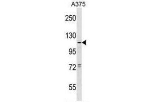 TAS1R1 Antibody (Center) western blot analysis in A375 cell line lysates (35µg/lane). (TAS1R1 antibody  (Middle Region))