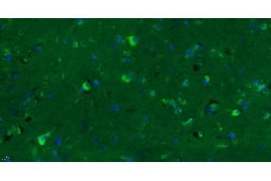 Paraformaldehyde-fixed, paraffin embedded Human glioma, Antigen retrieval by boiling in sodium citrate buffer (pH6. (GPR15 antibody  (AA 51-150) (Alexa Fluor 488))