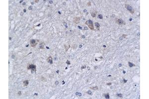 Formalin-fixed and paraffin embedded rat brain labeled with Anti-APAF1(NT) Polyclonal Antibody, Unconjugated (ABIN724310) followed by conjugation to the secondary antibody and DAB staining (APAF1 antibody  (AA 13-80))