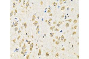 Immunohistochemistry (Paraffin-embedded Sections) (IHC (p)) image for anti-Protein tyrosine Phosphatase, Receptor Type, E (PTPRE) antibody (ABIN7263191)