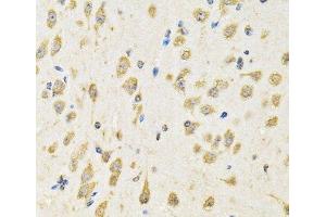 Immunohistochemistry of paraffin-embedded Mouse brain using PTPRE Polyclonal Antibody at dilution of 1:100 (40x lens). (PTPRE antibody)