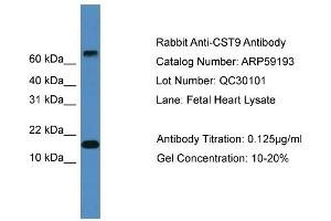 WB Suggested Anti-CST9  Antibody Titration: 0. (CST9 antibody  (Middle Region))