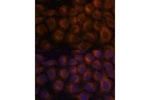 Immunofluorescence analysis of HeLa cells using V antibody  at dilution of 1:100. (VAV3 antibody  (AA 560-680))