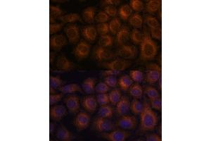 Immunofluorescence analysis of HeLa cells using V antibody  at dilution of 1:100. (VAV3 antibody  (AA 560-680))