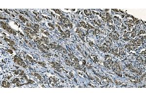 IHC analysis of CDC45L using anti-CDC45L antibody (ABIN7600230). (CDC45 antibody  (AA 166-431))