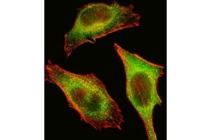 Fluorescent image of Hela cell stained with TEC Antibody (Center) (ABIN392111 and ABIN2841862). (NR4A3 antibody  (AA 175-205))