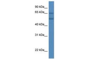 Image no. 1 for anti-Cytochrome P450, Family 2, Subfamily S, Polypeptide 1 (CYP2S1) (AA 319-368) antibody (ABIN6746052) (CYP2S1 antibody  (AA 319-368))