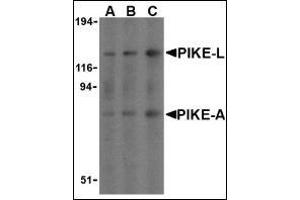 Western blot analysis of PIKE in mouse brain cell lysates with this product at (A) 0.
