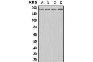 Western blot analysis of MERTK expression in Jurkat (A), HeLa (B), Raw264. (MERTK antibody  (N-Term))