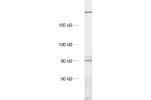 dilution: 1 : 1000, sample: crude synaptosomal fraction of rat brain (P2) (ITPR1 antibody)