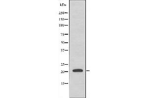 MRPL35 antibody  (Internal Region)