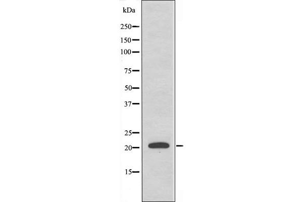 MRPL35 antibody  (Internal Region)