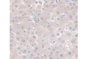 DAB staining on IHC-P;Samples:Human Liver Tissue. (CD73 antibody  (AA 29-500))