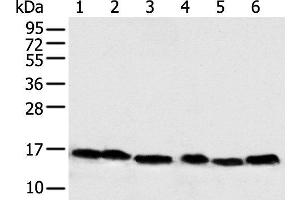 Western blot analysis of 293T Hela PC-3 Lncap and 231 cell Human fetal muscle tissue using NDUFB6 Polyclonal Antibody at dilution of 1:500 (NDUFB6 antibody)