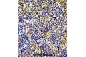 Immunohistochemistry (IHC) image for anti-IKAROS Family Zinc Finger 1 (Ikaros) (IKZF1) antibody (ABIN2995571)