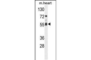 Western blot analysis of hFASTK-R534 in mouse heart tissue lysates (35ug/lane) (FASTK antibody  (C-Term))
