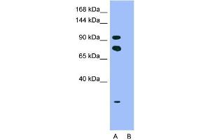 Western Blotting (WB) image for anti-Homeodomain Interacting Protein Kinase 2 (HIPK2) (Middle Region) antibody (ABIN2779735)