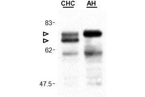 Cardif is cleaved in liver of a patient infected by the hepatitis C virus. (MAVS antibody  (AA 160-450))