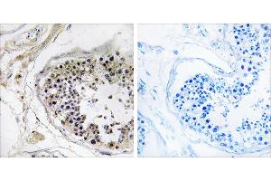 Peptide - +Immunohistochemistry analysis of paraffin-embedded human testis tissue using CST8 antibody. (CST8 antibody)