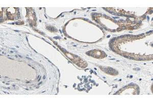 ABIN6267611 at 1/100 staining Human prostate tissue by IHC-P. (LIPE antibody  (pSer554, pSer855))