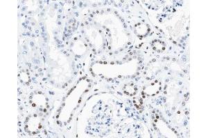 ABIN6267462 at 1/100 staining human kidney tissue sections by IHC-P. (Cyclin D3 antibody  (pThr283))