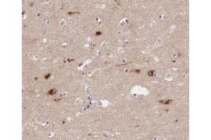 ABIN6267409 at 1/200 staining human brain tissue sections by IHC-P. (JunB antibody  (pSer259))