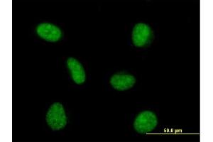 Immunofluorescence of purified MaxPab antibody to PRPF4 on HeLa cell. (PRPF4 antibody  (AA 1-522))