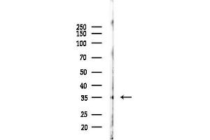 anti-G Protein-Coupled Bile Acid Receptor 1 (GPBAR1) antibody
